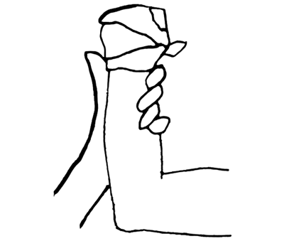 Wound