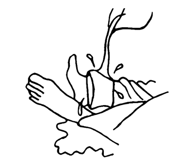 Wound