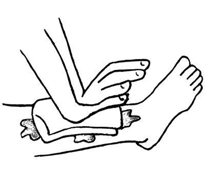 Wound