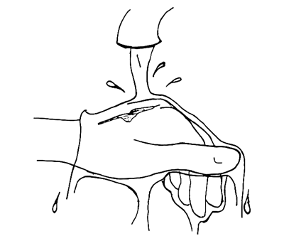 Wound